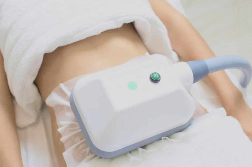 How Fat Freezing and HIFU Work Together? 3 advantages to combining Fat Freezing and HIFU Redhill