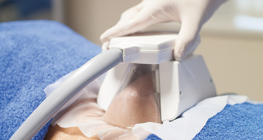 How Fat Freezing and HIFU Work Together? 2 Multiple Areas in One Session HIFU and Fat Freezing Redhill