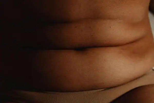 The Hidden Connection: How Stress Shapes Your Fitness and Body Composition 3 image of what stress can do on the stomach area and how Lipo 360 Redhill can help to change your body shape.